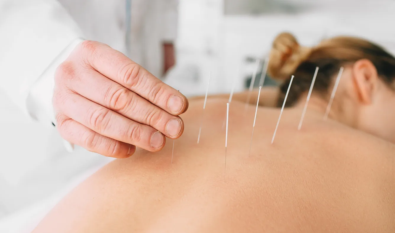 Why is Dry Needling Illegal in Some States?